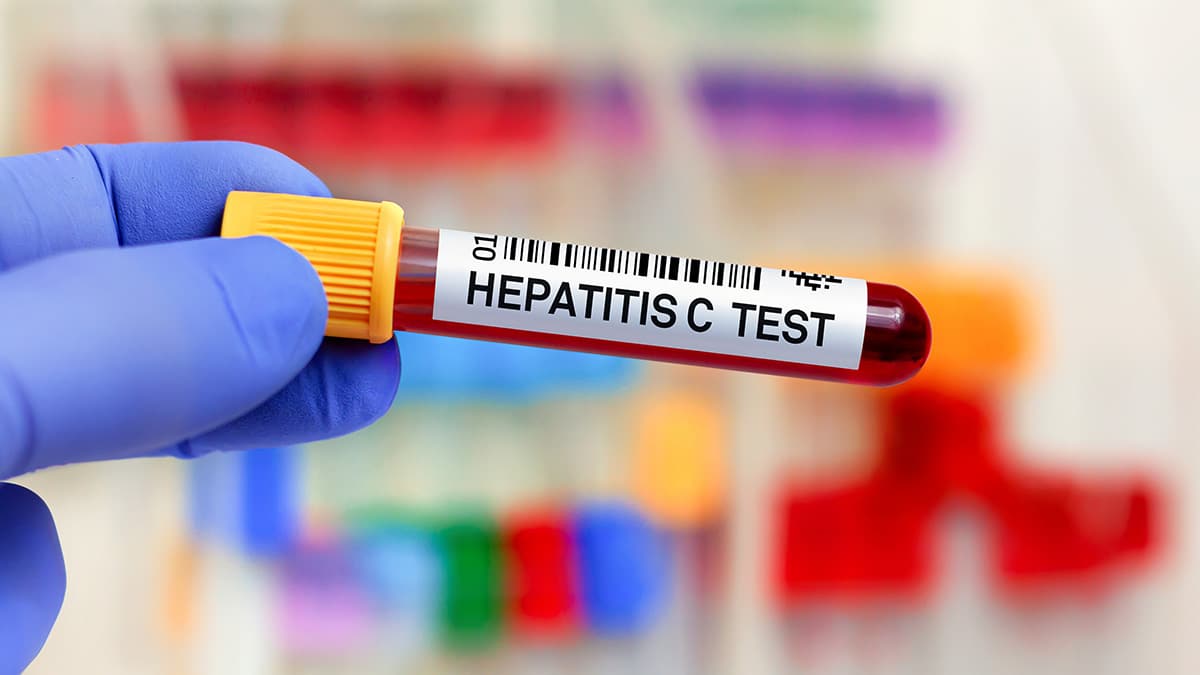 hepatitis-c-testing-thumbnail Hepatitis C testing CDC image